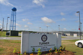 turner sign